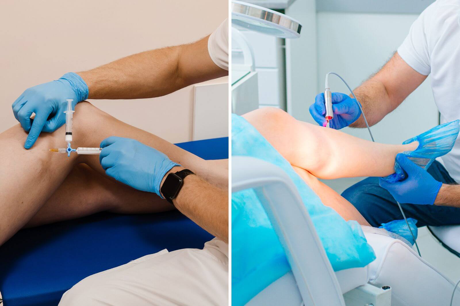 What Are Varicose Veins & When Should You See a Doctor?